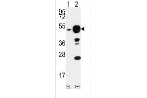 Western blot analysis of EIF4A1 (arrow) using rabbit polyclonal EIF4A1 Antibody (N-term) (ABIN391393 and ABIN2841397). (EIF4A1 Antikörper  (N-Term))