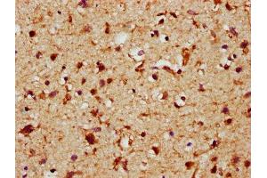 Immunohistochemistry (IHC) image for anti-Fibroblast Growth Factor 1 (Acidic) (FGF1) (AA 16-155) antibody (ABIN7152772)