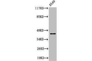 Western Blotting (WB) image for anti-Matrix Metallopeptidase 3 (Stromelysin 1, Progelatinase) (MMP3) (Cleaved-Phe100) antibody (ABIN7187328)
