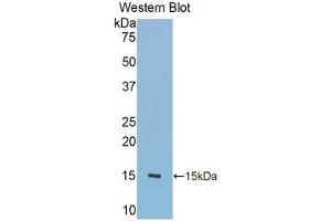 Western blot analysis of the recombinant protein. (TNC Antikörper  (AA 513-621))