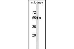 Mouse Pnpla3 Antibody (C-term) (ABIN1537205 and ABIN2850147) western blot analysis in mouse kidney tissue lysates (35 μg/lane).