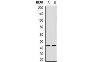 Western blot analysis of MAPKAPK3 expression in Hela (A), Jurkat (B) whole cell lysates. (MAPKAP Kinase 3 Antikörper  (C-Term))