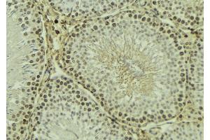ABIN6269091 at 1/100 staining Mouse testis tissue by IHC-P. (Integrin beta 3 Antikörper  (C-Term))