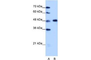 WB Suggested Anti-HNRPF Antibody Titration:  1. (HNRNPF Antikörper  (C-Term))