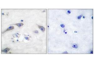 Immunohistochemistry (IHC) image for anti-Protein Phosphatase 1, Regulatory (Inhibitor) Subunit 1B (PPP1R1B) (Thr75) antibody (ABIN1847886) (DARPP32 Antikörper  (Thr75))