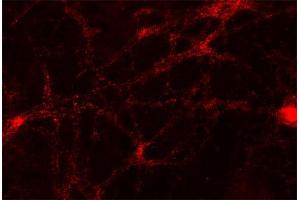 Indirect immunofluorescence labeling of PFA fixed rat hippocampus neurons (dilution 1 : 500). (Uncoating ATPase (AA 1-650) Antikörper)