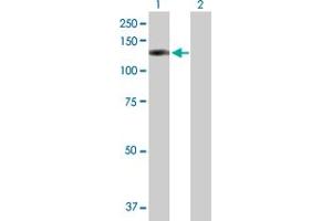 Western Blot analysis of OSBPL8 expression in transfected 293T cell line by OSBPL8 MaxPab polyclonal antibody. (OSBPL8 Antikörper  (AA 1-847))