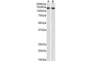 ABIN5539937 (0. (CCAR2 Antikörper  (AA 842-855))