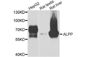 Western blot analysis of extracts of various cell lines, using ALPP antibody. (PLAP Antikörper)