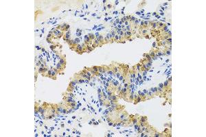 Immunohistochemistry of paraffin-embedded mouse lung using UVRAG antibody at dilution of 1:100 (x40 lens). (UVRAG Antikörper)