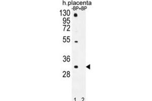 Western Blotting (WB) image for anti-Olfactory Receptor, Family 1, Subfamily D, Member 5 (OR1D5) antibody (ABIN2996487) (OR1D5 Antikörper)