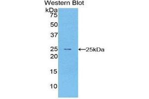 Western Blotting (WB) image for anti-Peripheral Myelin Protein 22 (PMP22) (AA 31-133) antibody (ABIN1860271) (PMP22 Antikörper  (AA 31-133))