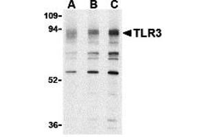 Western Blotting (WB) image for anti-Toll-Like Receptor 3 (TLR3) (N-Term) antibody (ABIN1031621) (TLR3 Antikörper  (N-Term))