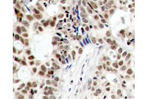 Immunohistochemistry (IHC) image for anti-Breast Cancer 1 (BRCA1) (pSer1423) antibody (ABIN3019881) (BRCA1 Antikörper  (pSer1423))