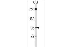 Western Blotting (WB) image for anti-Ral Guanine Nucleotide Dissociation Stimulator-Like 2 (RGL2) (AA 152-180), (N-Term) antibody (ABIN657382)
