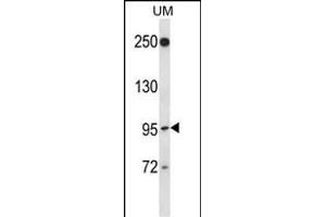 RGL2 Antibody (N-term) (ABIN657382 and ABIN2846427) western blot analysis in uterine tumor cell line lysates (35 μg/lane). (RGL2 Antikörper  (N-Term))