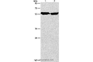 Western blot analysis of Mouse heart and human fetal brain tissue, using ARHGEF9 Polyclonal Antibody at dilution of 1:950 (Arhgef9 Antikörper)