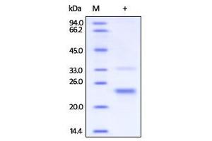 Human CD160, His Tag on SDS-PAGE under reducing (R) condition.