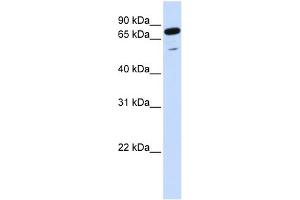 WB Suggested Anti-PPP1R13L Antibody Titration:  0. (PPP1R13L Antikörper  (Middle Region))