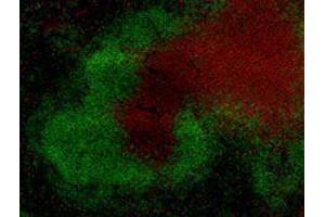 Immunofluorescence (IF) image for anti-T Cell Receptor (TCR) beta (TCR beta) antibody (Alexa Fluor 594) (ABIN2656861)