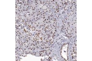 Immunohistochemical staining of human pancreas with TFAP4 polyclonal antibody  shows moderate nuclear positivity in exocrine glandular cells and islet cells. (TFAP4 Antikörper)