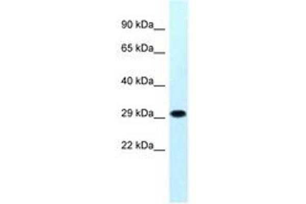 MRPS18B Antikörper  (AA 45-94)