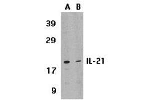 Western Blotting (WB) image for anti-Interleukin 21 (IL21) (Middle Region) antibody (ABIN1030955) (IL-21 Antikörper  (Middle Region))