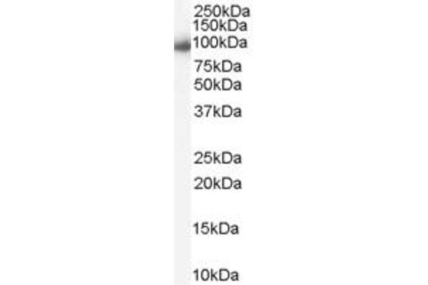 KPNB1 Antikörper  (C-Term)