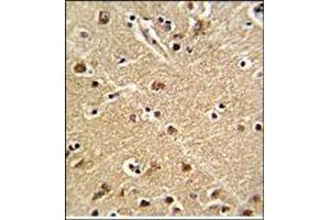 Immunohitochemistry: ZWINT Antibody staining of Formalin-Fixed, Paraffin-Embedded Human Brain Tissue.