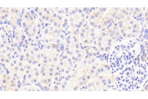 Immunohistochemistry (IHC) image for anti-Complement Factor I (CFI) (AA 28-243) antibody (ABIN7444067)