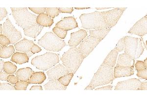 Immunohistochemistry (IHC) image for anti-Fatty Acid Binding Protein 3, Muscle and Heart (FABP3) (AA 1-133) antibody (ABIN7433315)