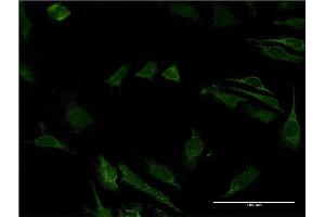 Immunofluorescence of monoclonal antibody to CD40 on HeLa cell. (CD40 Antikörper  (AA 21-193))