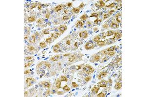 Immunohistochemistry of paraffin-embedded human stomach using MTTP antibody (ABIN5970876) at dilution of 1/100 (40x lens). (MTTP Antikörper)