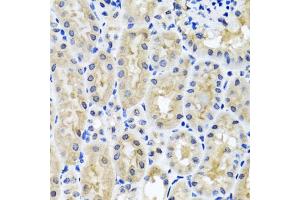 Immunohistochemistry of paraffin-embedded mouse kidney using SNAP29 antibody. (SNAP29 Antikörper)