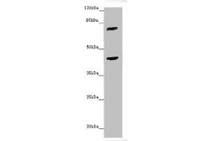 Western blot All lanes: ACSL6 antibody at 4. (ACSL6 Antikörper  (AA 458-697))