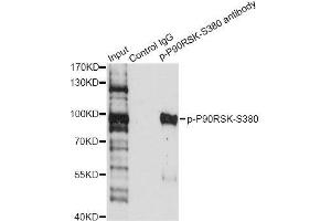 Immunoprecipitation analysis of 200 μg extracts of HeLa cells treated by EGF using 2. (RPS6KA3 Antikörper  (pSer380))
