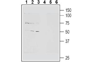 Western blot analysis of human  monocytic leukemia cell line lysates (lanes 1 and 4), mouse  microglia cell line lysates (lanes 2 and 5) and human Raji B lymphoblastoid cell line lysate (lanes 1 and 6):1-3.
