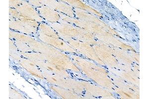 ABIN6264983 and ABIN6266656 at 1/100 staining Rat skin tissue by IHC-P. (SENP1 Antikörper  (N-Term))