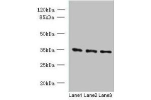 Western blot All lanes: C15orf41 antibody at 1. (BC052040 Antikörper  (AA 1-183))