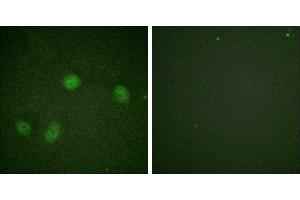 P-peptide - +Immunofluorescence analysis of HeLa cells, using Raf1 (Phospho-Ser621) antibody. (RAF1 Antikörper  (pSer621))