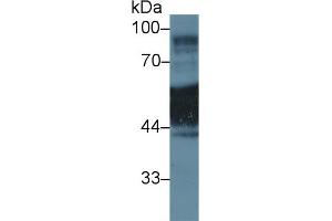 Western blot analysis of Human A431 cell lysate, using Rat KRT1 Antibody (1 µg/ml) and HRP-conjugated Goat Anti-Rabbit antibody ( (Cytokeratin 1 Antikörper  (AA 350-488))