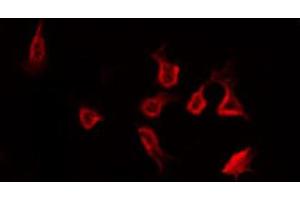 ABIN6266449 staining Hela by IF/ICC. (CCR5 Antikörper  (pSer349))
