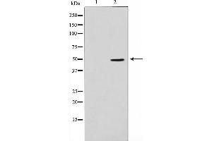 Western blot analysis on Jurkat cell lysate using ADPGK Antibody,The lane on the left is treated with the antigen-specific peptide. (ADPGK Antikörper  (Internal Region))