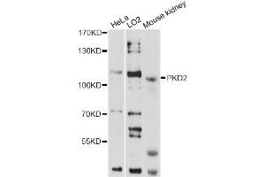 Western blot analysis of extracts of various cell lines, using PKD2 antibody (ABIN1874147) at 1:1000 dilution. (PKD2 Antikörper)