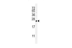GAGE12B Antibody (N-term) (ABIN655201 and ABIN2844816) western blot analysis in T47D cell line lysates (35 μg/lane). (G Antigen 12B Antikörper  (N-Term))