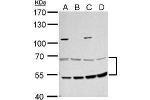 WB Image MCD antibody detects MCD protein by western blot analysis. (MLYCD Antikörper)