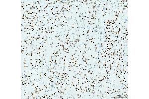 anti-Histone Deacetylase 2 (HDAC2) (AA 387-488) antibody