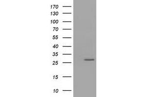 Western Blotting (WB) image for anti-OTU Domain, Ubiquitin Aldehyde Binding 2 (OTUB2) antibody (ABIN1499939) (OTUB2 Antikörper)