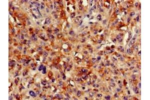 Immunohistochemistry (IHC) image for anti-Hydroxymethylbilane Synthase (HMBS) (AA 283-330) antibody (ABIN7163904)