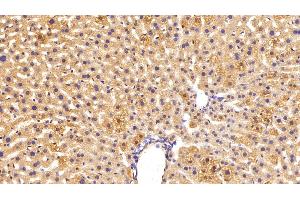 Detection of C3 Convertase in Mouse Liver Tissue using Polyclonal Antibody to Complement C3 Convertase (C3 Convertase) (Complement C3 Convertase Antikörper)